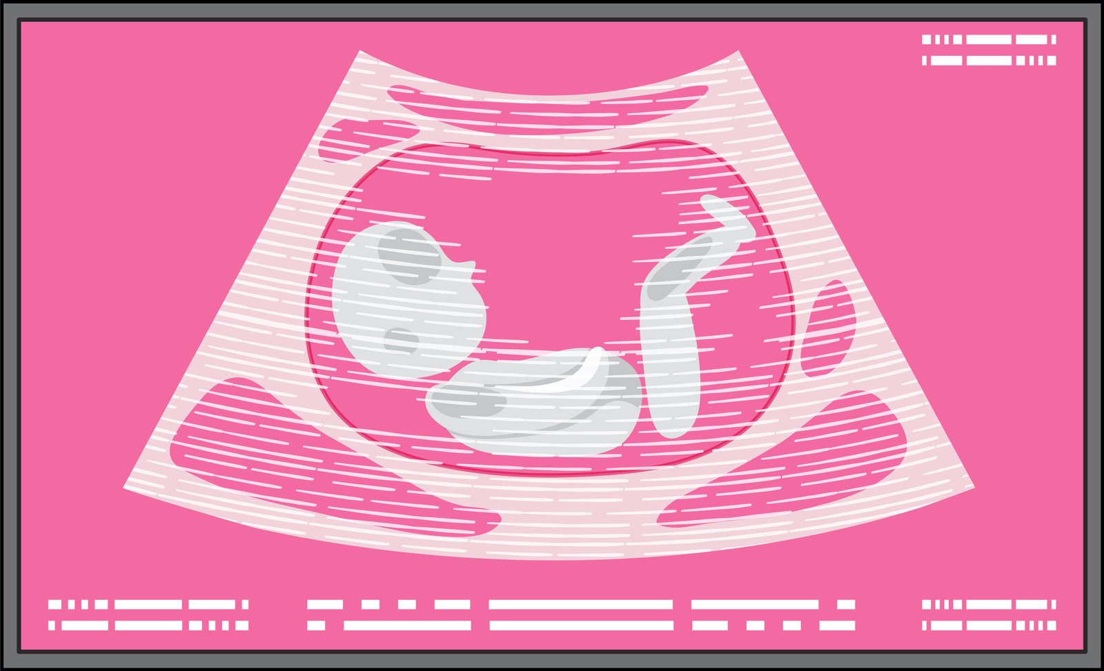 Fetal Scan Icon
